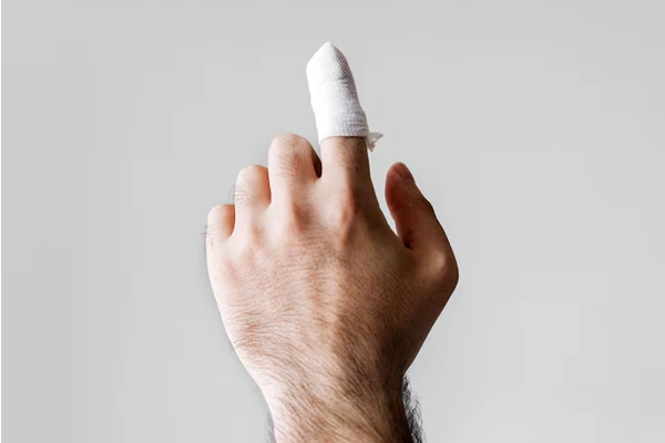 Fingertip Injuries