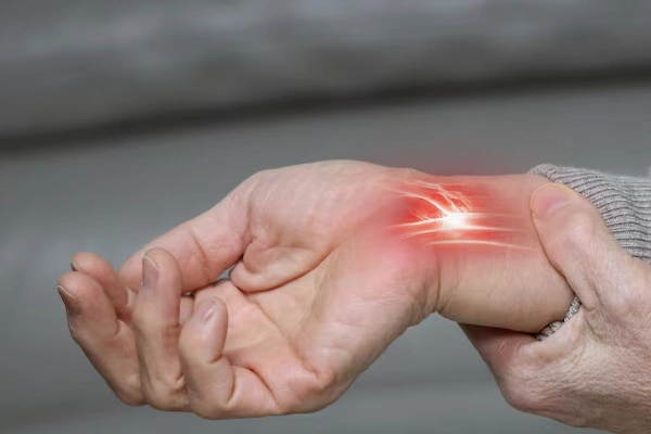 Carpal Tunnel and Cubital Tunnel Surgery