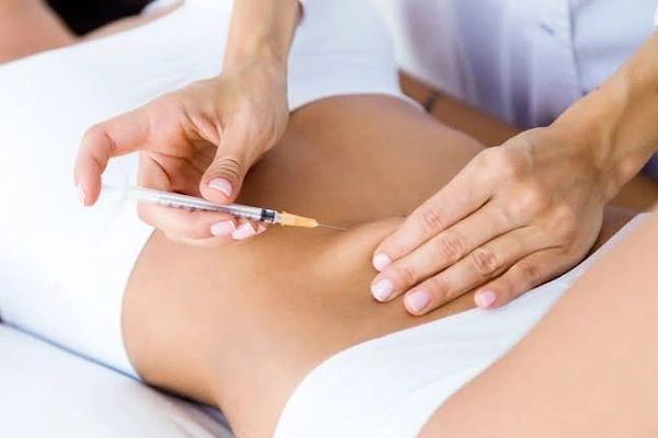Liposuction