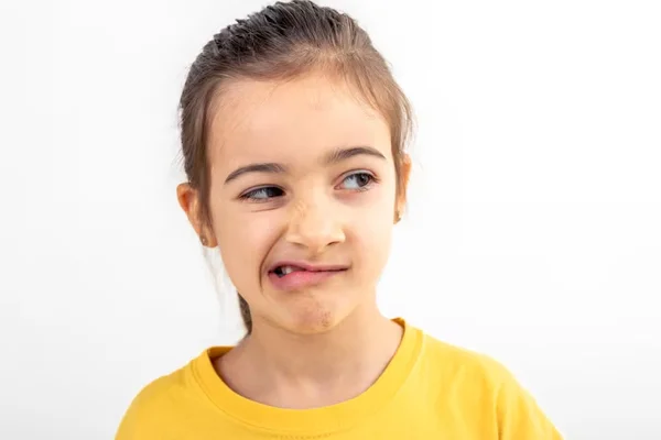 Cleft Lip