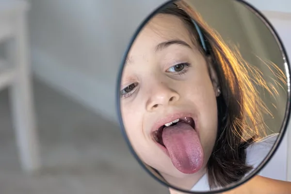 Cleft Palate